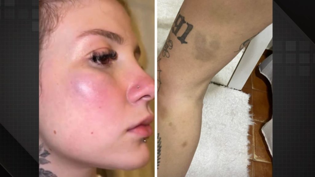 Clara Monteiro revela episódios de agressão em relacionamento tóxico.