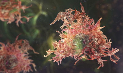 Adolescente sobrevive a Naegleria fowleri, doença rara causada por ameba comedora de cérebro