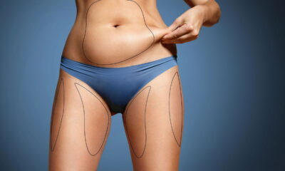Adeus, gordura abdominal! Estratégias eficazes para um mês de transformação