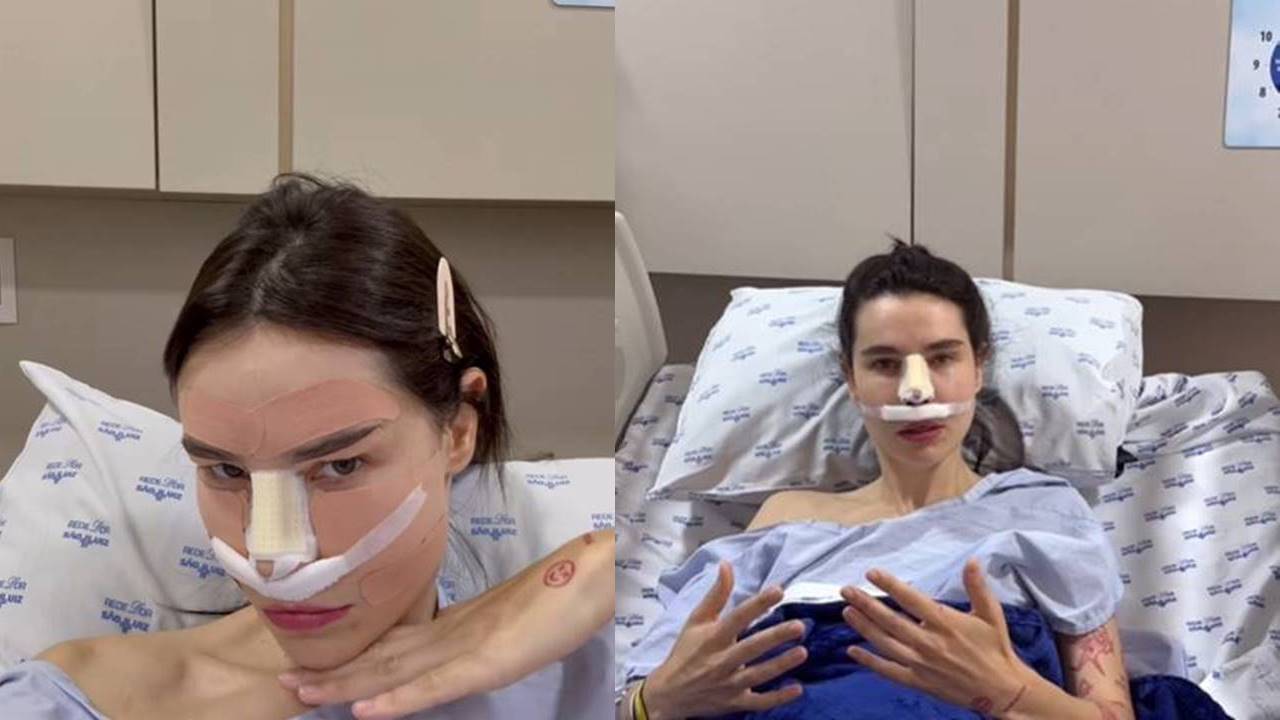 Ellen Milgrau faz plástica no nariz e ignora ordens médicas!