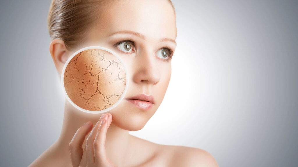 5 dicas para acabar com a pele seca agora mesmo
