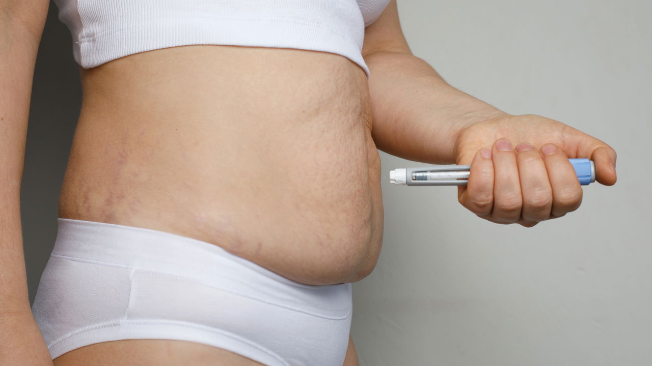 Canetas para emagrecer conquistam quem quer secar de vez