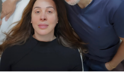 Adeus, flacidez! Saiba como os fios de colágeno podem revolucionar seu rosto