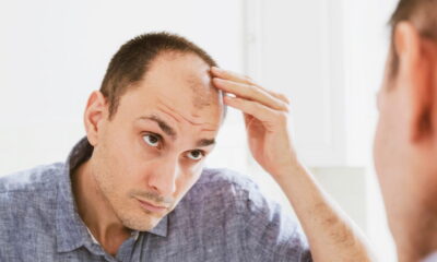 Nova molécula promete fim da calvície mesmo em carecas