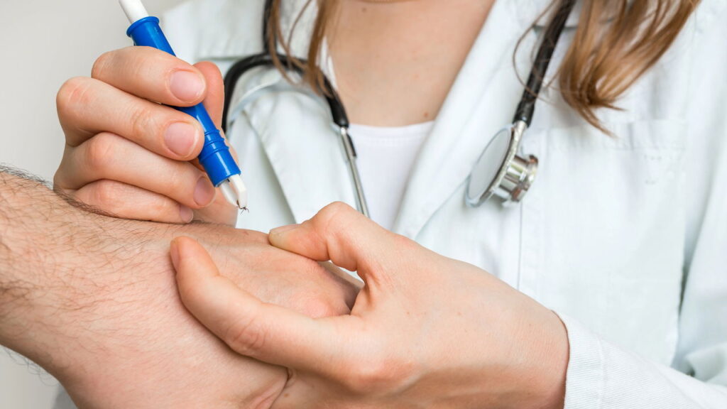 Seu tipo sanguíneo pode te colocar na mira dos carrapatos