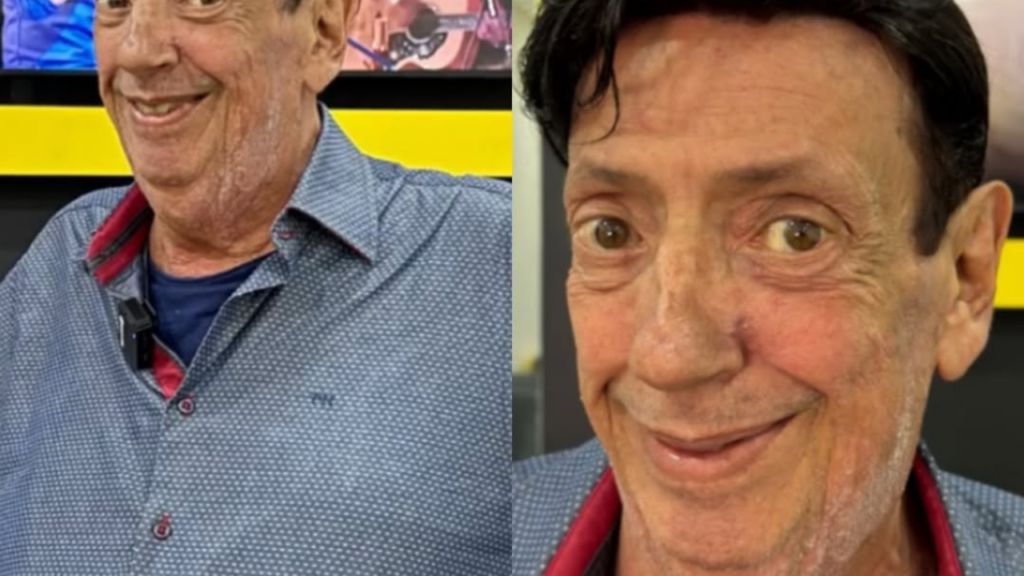 Ator do Beiçola revela transformação capilar e encanta fãs