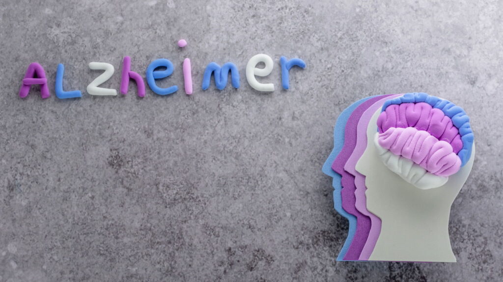 Esses 5 sinais podem ser Alzheimer e quase ninguém percebe
