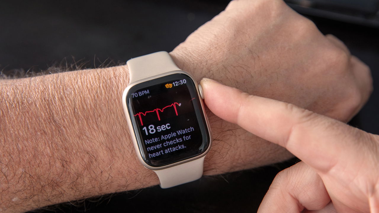 Smartwatch inovador que monitora seu corpo como um médico