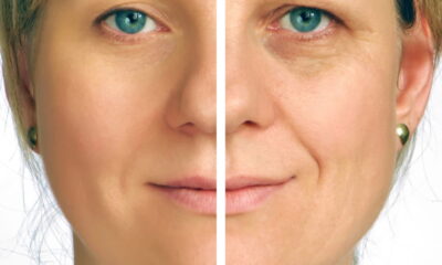 Essas duas fases da vida aceleram seu envelhecimento