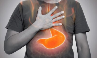 Essa folha alivia gastrite e quase ninguém conhece