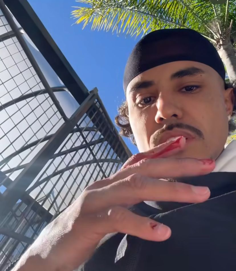 MC Livinho: Foto: Reprodução/ Instagram