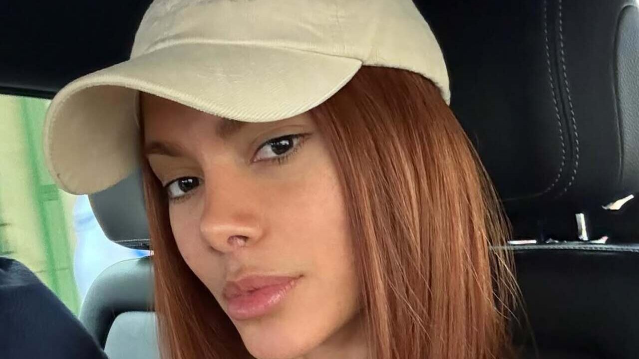 O que está por trás do rosto diferente de Anitta e por que isso virou tendência?