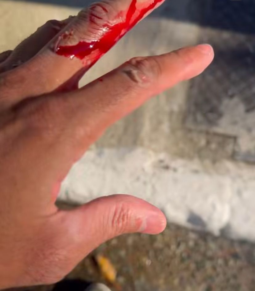 MC Livinho: Foto: Reprodução/ Instagram