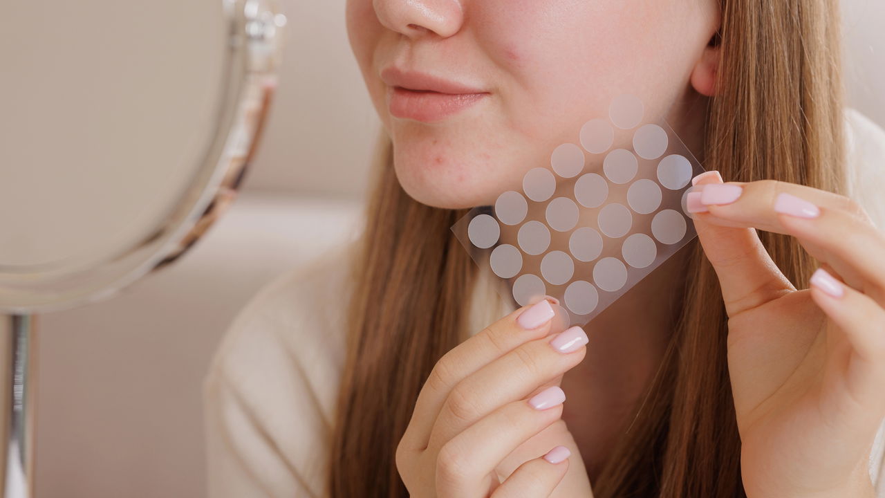 Adesivo antiacne invisível seca espinhas rapidamente