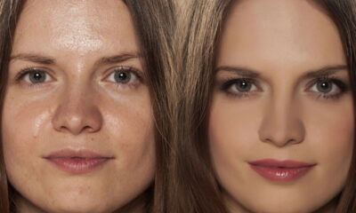 Pele oleosa nunca mais com esse hábito simples no rosto