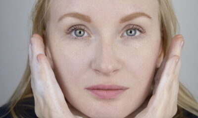 Erro comum pode piorar a pele sensível e mista sem aviso