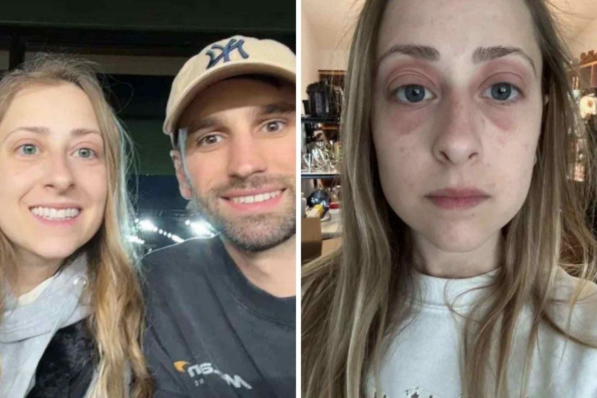 Mulher descobre mofo em casa após notar erupções em selfies