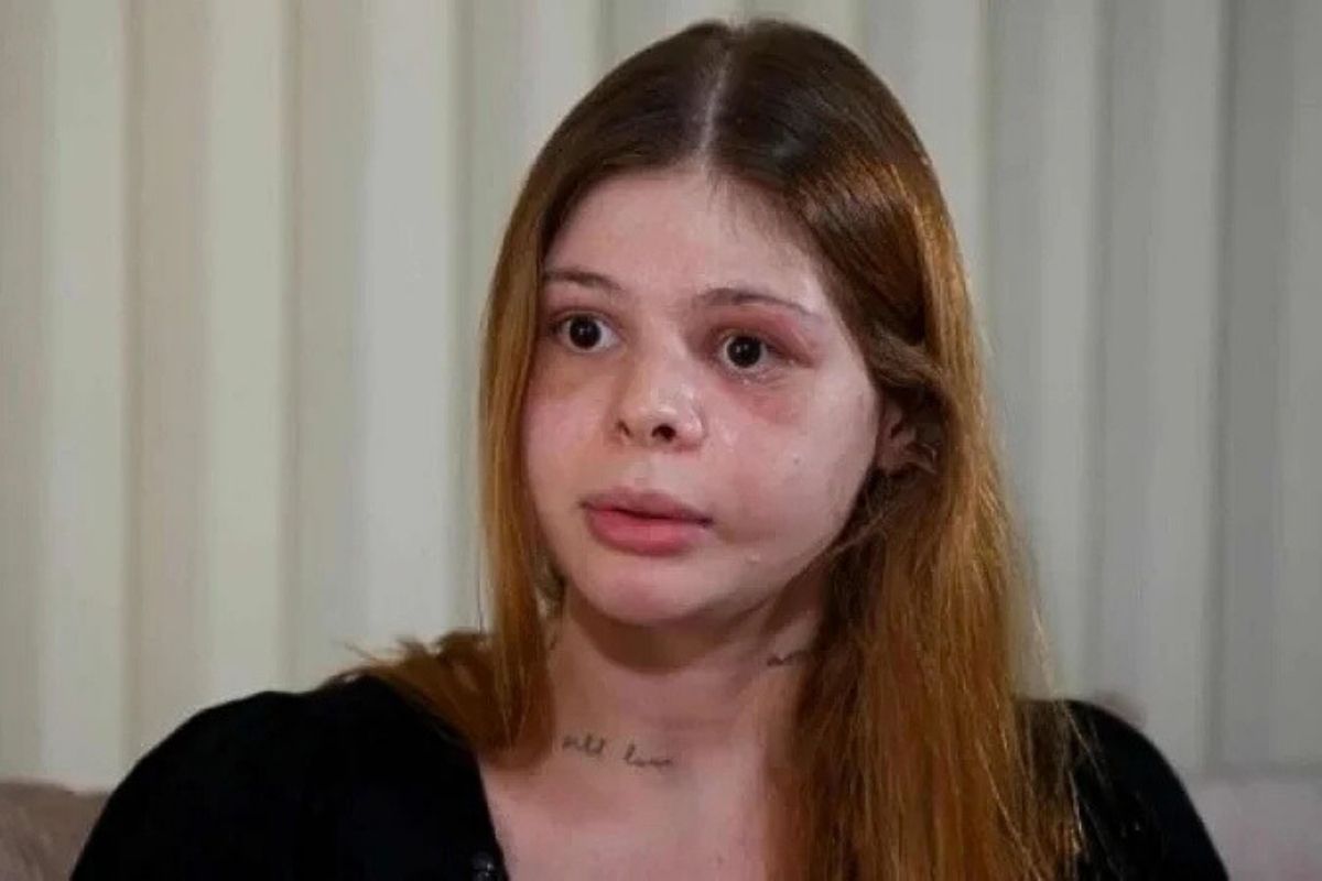Médica agredida por ex perde sorriso e parte da visão após ataque