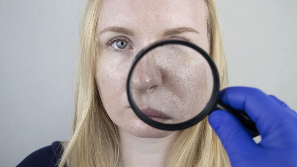 Pele oleosa piora com produtos inadequados de skincare