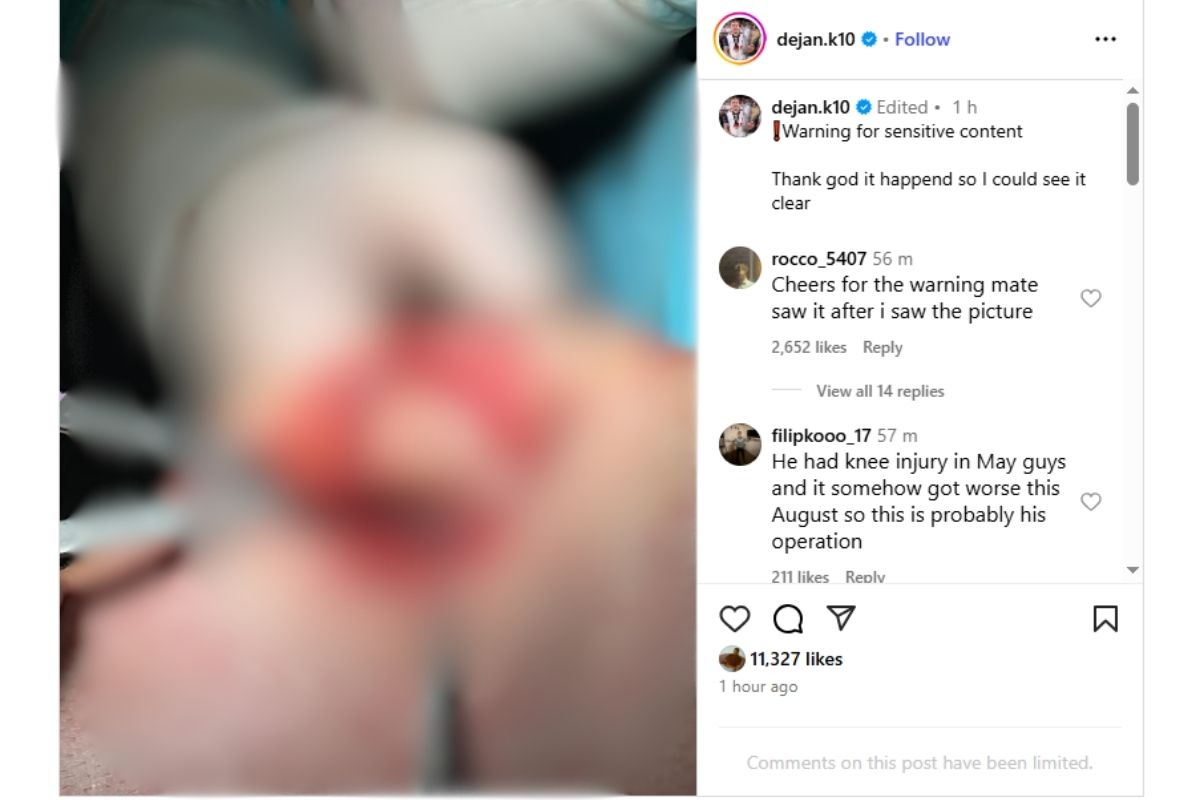 Foto do joelho de Dejan Kulusevski aberto na cirurgia. Foto: Reprodução/Instagram