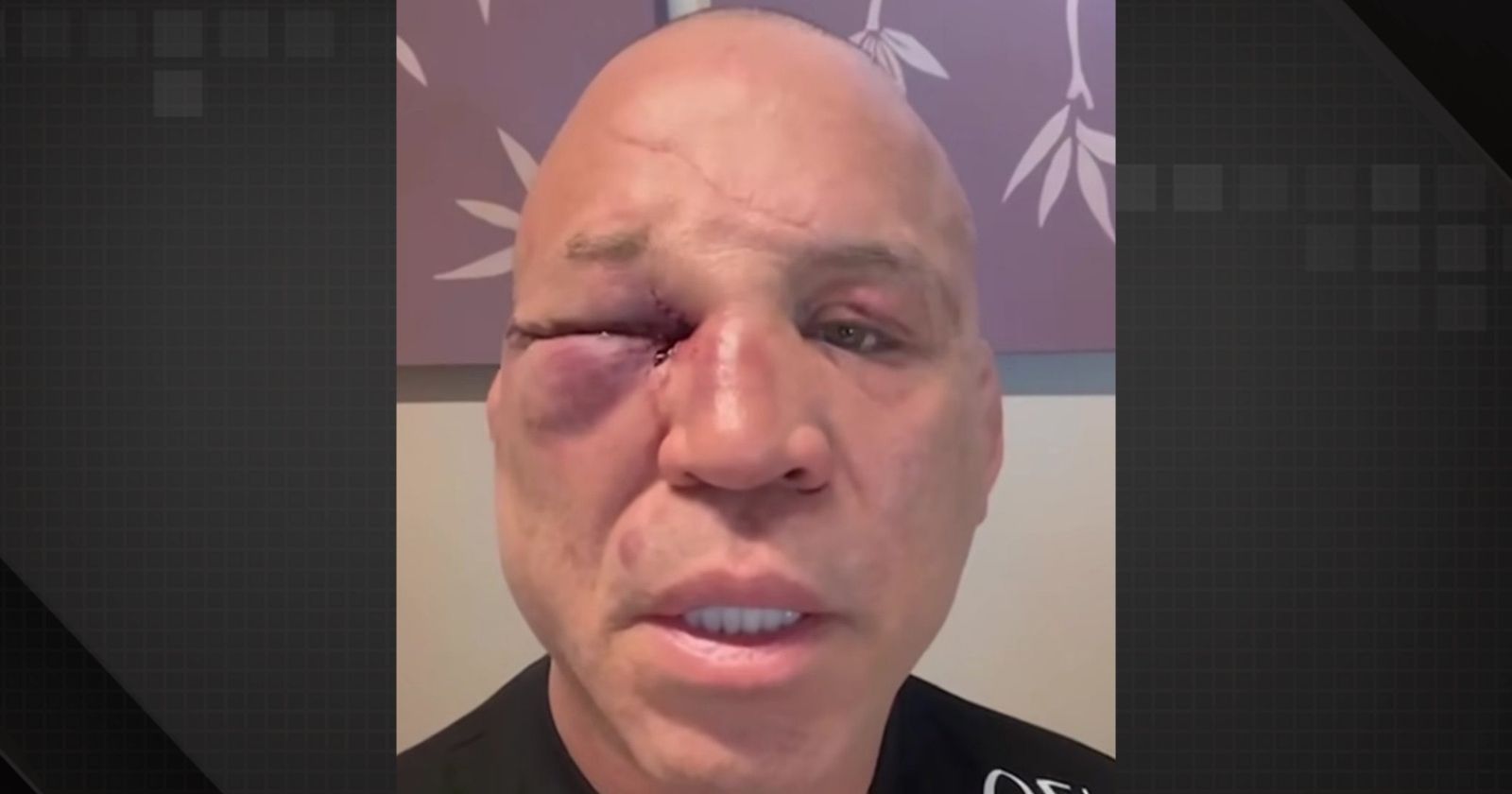 Wanderlei Silva nocauteado Foto: Reprodução