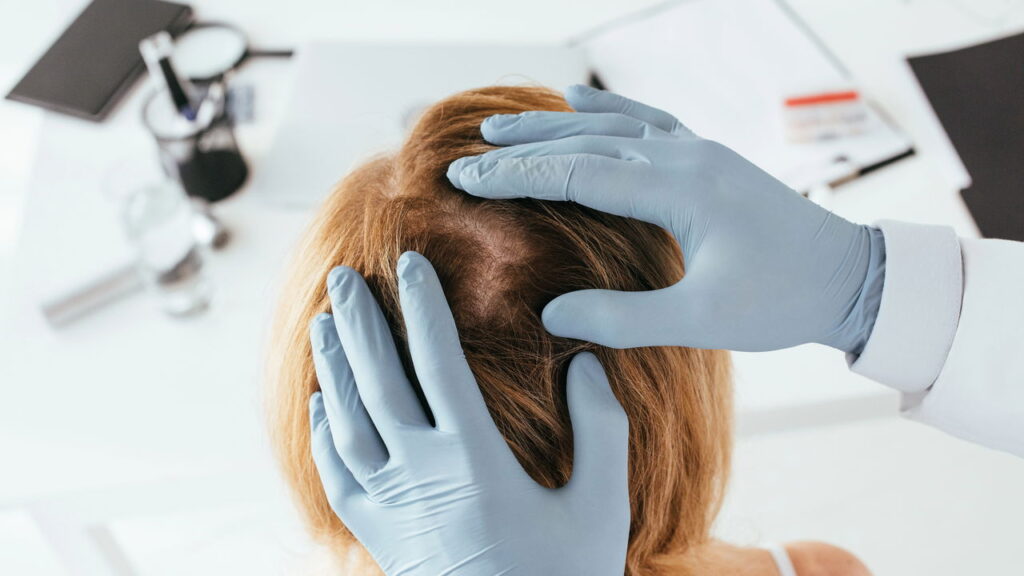 Passar por procedimentos químicos no cabelo é uma prática comum para quem deseja mudar o visual, mas pode provocar efeitos colaterais indesejados