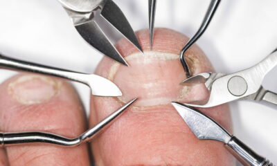 Cuidar das unhas vai muito além de esmaltar e lixar; o manejo correto das cutículas é essencial para preservar a saúde das mãos