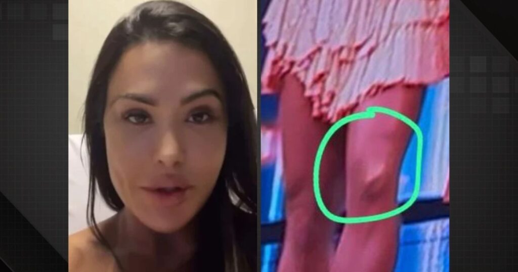 Em cama de hospital, Gracyanne faz desabafo sobre acidente grave