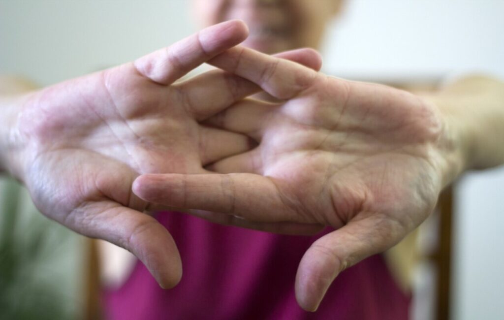 O que acontece quando estalas os dedos todos os dias
