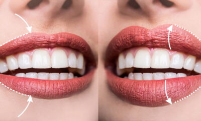 Tenha lábios perfeitos sem botox com este truque