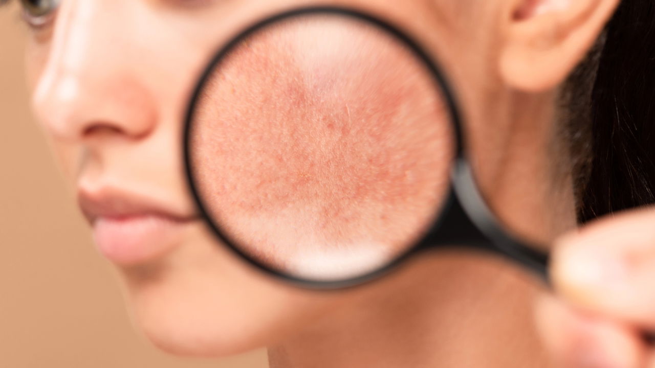 O ingrediente natural que clareia manchas na pele