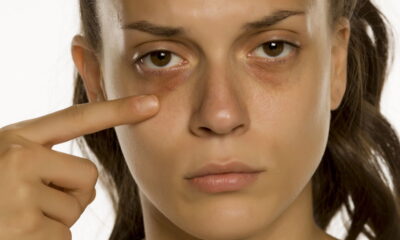 O truque que elimina olheiras em minutos