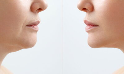 Se sua papada incomoda, vale testar essas dicas simples e sem exagero