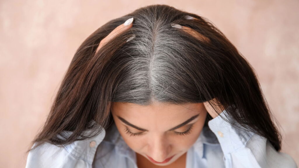 Quando a raiz do cabelo cresce mais rápido que o normal, isso pode sinalizar não só mudanças fisiológicas naturais, mas também fatores externos que afetam a saúde do couro cabeludo