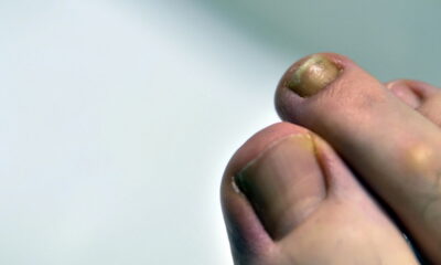 Quando o esmalte nas unhas começa a escurecer, muitas pessoas ficam em dúvida sobre as razões por trás dessa alteração de cor