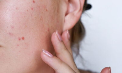 Você já se perguntou por que seu esmalte descasca tão rapidamente? A resposta pode estar nas suas unhas oleosas