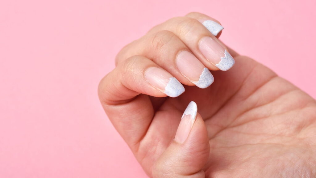 Unhas que descascam