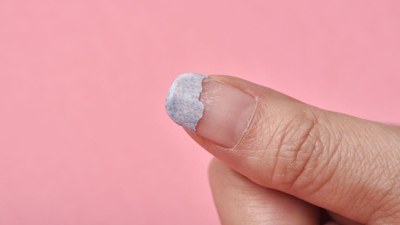 Unhas que descascam
