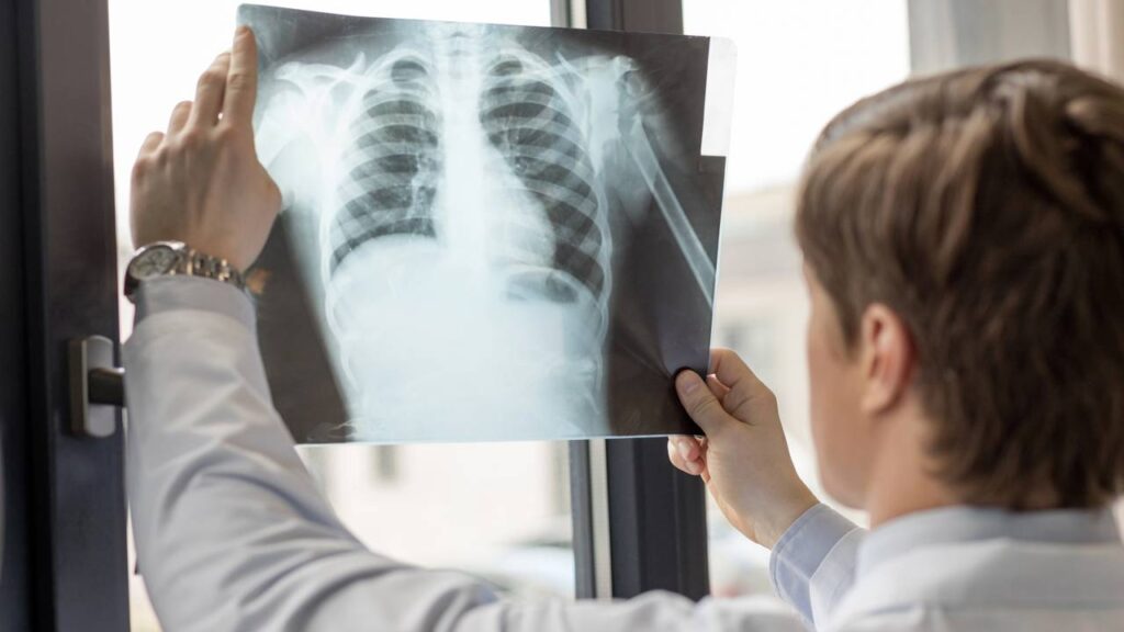 Você já se perguntou qual é o plural de tórax? A língua portuguesa apresenta nuances interessantes, especialmente quando o assunto são os plurais