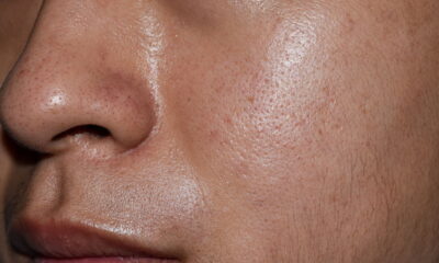 Dicas para cuidar da pele oleosa com rotina simples de manhã e noite