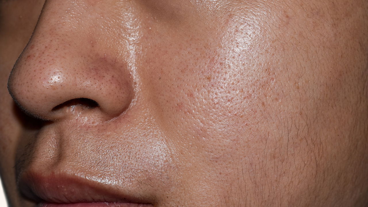 Dicas para cuidar da pele oleosa com rotina simples de manhã e noite