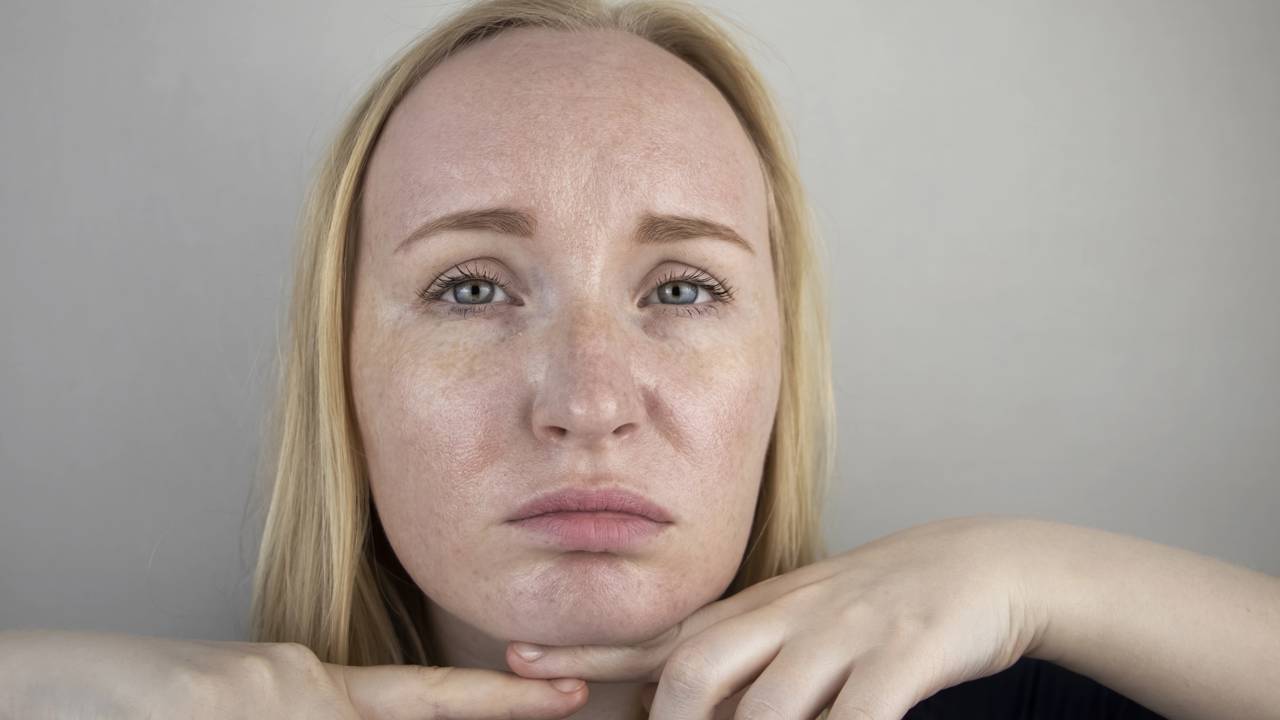 Chá verde é uma solução natural reconhecida por ajudar a reduzir a oleosidade do rosto rapidamente. Sua ação antioxidante e adstringente transforma o chá verde