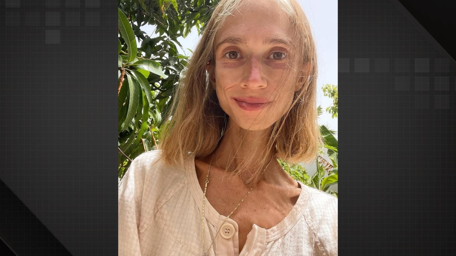 Estudante polonesa morre em Bali após seguir dieta restritiva de frutas