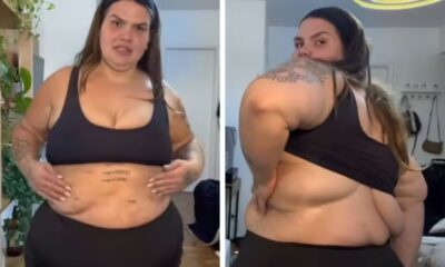 Thais Carla faz “tour” pelo corpo após perder 75 kg e explica cicatrizes