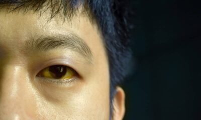 Pele amarelada? O que esse sinal pode estar tentando te dizer