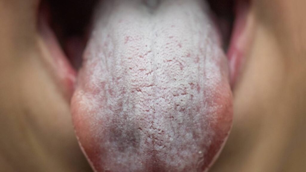 Quando o corpo pede mais água, esse sinal costuma aparecer primeiro