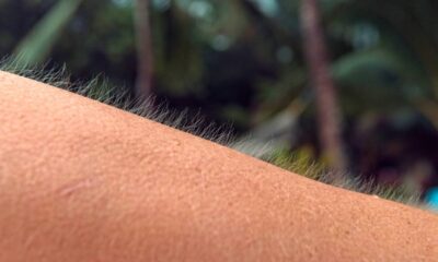 Por que o cabelo arrepia quando o tempo vai mudar