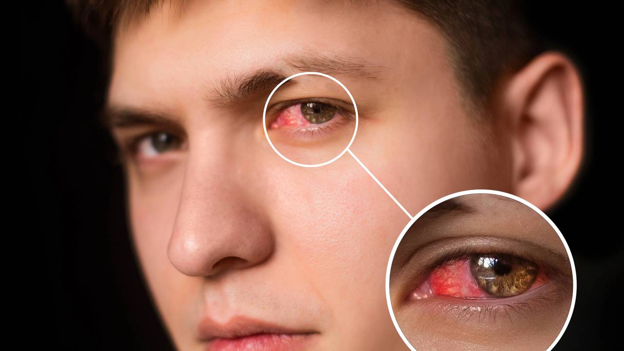 Um sinal discreto no olho pode indicar problemas mais sérios do que parece