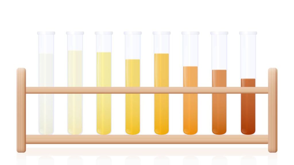 O que significa quando a cor da urina muda de repente
