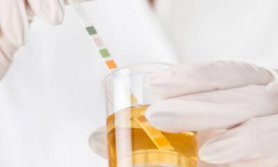 O que significa quando a cor da urina muda de repente